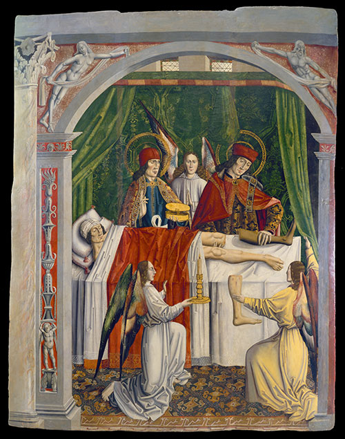 Οι Άγιοι Κοσμάς και Δαμιανός ενώ χειρουργούν μεταμόσχευση σε πόδι ασθενούς Πίνακας ζωγραφικής αρχές του 15ου αιώνα.