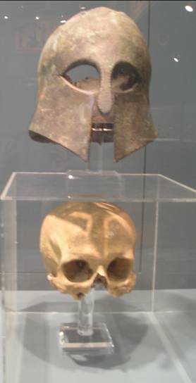 Κορινθιακή περικεφαλαία και το κρανίο που ανήκουν σ' ένα Αθηναίο στρατιώτη, που πολέμησε στον Μαραθώνα. Βρίσκεται στο βασιλικό μουσείο του Οντάριο.